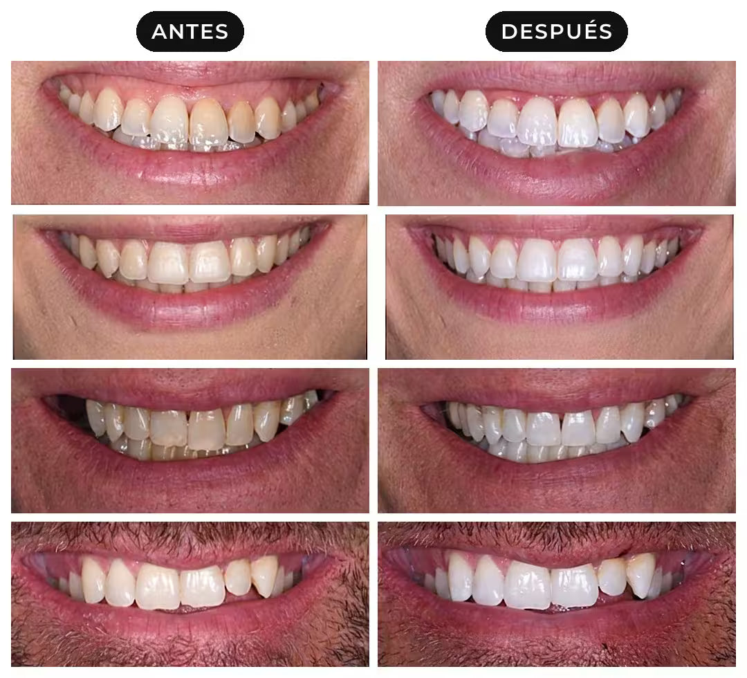 KOMERSIC™ Tiras Blanqueadoras V34+